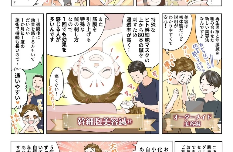 清水区｜美容鍼