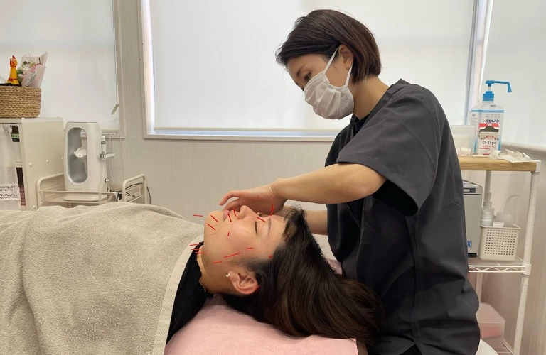 鍼治療で若返り実感！ほうれい線を撃退し、素肌を再生させましょう。