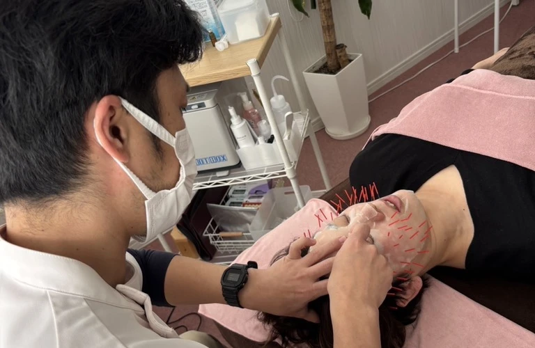 美容鍼の力でお肌に若返りを、リフトアップとたるみ改善を実現しませんか？