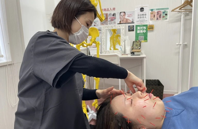 肩こりも改善しながら美肌へ！美容鍼の効果