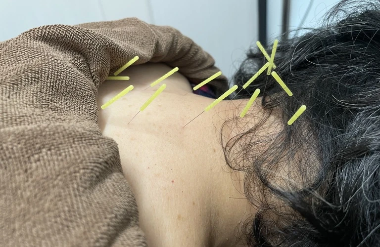 体の痛みを軽減し、快適な日常を取り戻すサポート