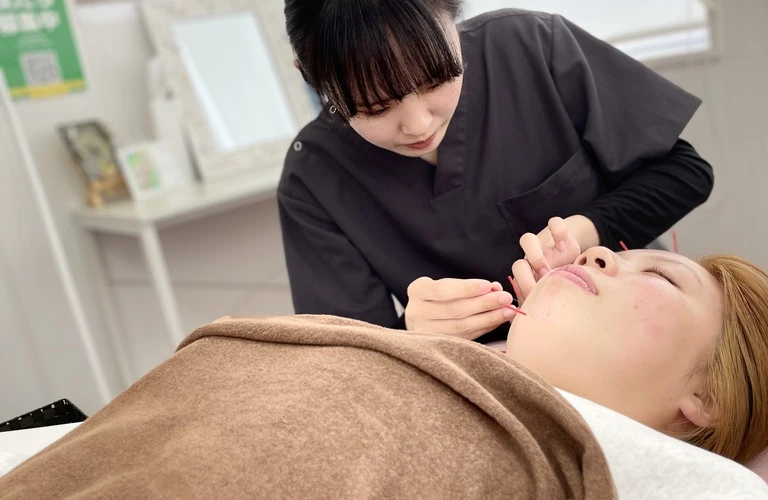 たるみ知らずの若々しい肌へ！美容鍼の力で自然なリフトアップ