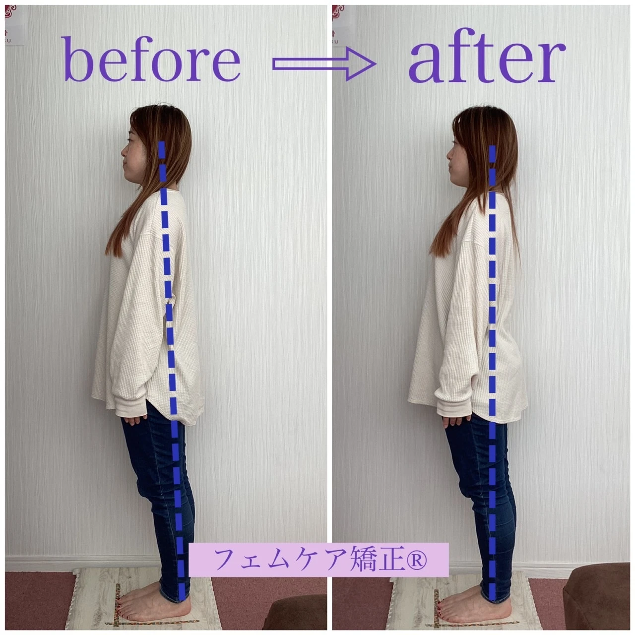 腰痛やしびれ、悩んでいるあなたへ。