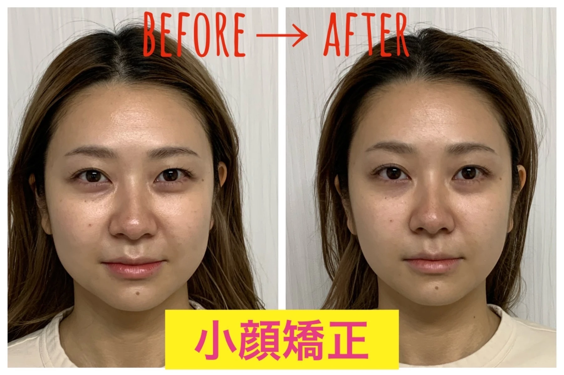 5. 美容効果を追求する施術